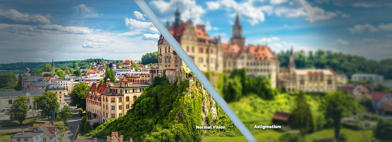 Astigmatism Treatment in North Garland